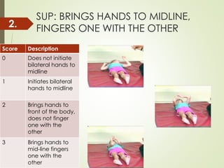 SUP: BRINGS HANDS TO MIDLINE,
FINGERS ONE WITH THE OTHER
Score Description
0 Does not initiate
bilateral hands to
midline
1 Initiates bilateral
hands to midline
2 Brings hands to
front of the body,
does not finger
one with the
other
3 Brings hands to
mid-line fingers
one with the
other
2.
 