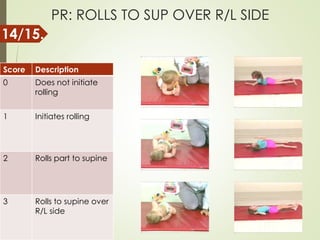 PR: ROLLS TO SUP OVER R/L SIDE
Score Description
0 Does not initiate
rolling
1 Initiates rolling
2 Rolls part to supine
3 Rolls to supine over
R/L side
14/15.
 