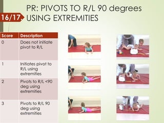 PR: PIVOTS TO R/L 90 degrees
USING EXTREMITIES
Score Description
0 Does not initiate
pivot to R/L
1 Initiates pivot to
R/L using
extremities
2 Pivots to R/L <90
deg using
extremities
3 Pivots to R/L 90
deg using
extremities
16/17.
 