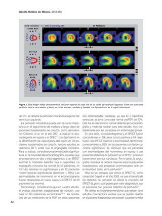 Gaceta Médica de México. 2012;148




     Figura 3. Esta imagen refleja directamente la perfusión regional de cada una de las caras del ventrículo izquierdo. Existe una adecuada
     perfusión para la cara anterior y lateral en cortes apicales, mediales y basales, con hipoperfusión en la región inferoseptal.



     la FEVI, se obtiene la perfusión miocárdica regional del             con enfermedades cardíacas, ya sea IC o hipertrofia
     ventrículo izquierdo.                                                ventricular, se toma como valor normal una FEVI del 50%.
        La perfusión miocárdica puede ser de suma impor-                  Este fue el valor mínimo normal obtenido por ecocardio-
     tancia en el seguimiento de mediano y largo plazo de                 grafía y medicina nuclear para este estudio, muy pro-
     pacientes trasplantados de corazón, como demostra-                   bablemente por ser corazones sin enfermedad previa.
     ron Ciliberto, et al. en el año 2001 al evaluar la eco-                 En otra serie, el ecocardiograma y el SPECT fueron
     cardiografía en reposo y el SPECT con dipiridamol en                 concordantes en 59 casos (cinco positivos y 54 nega-
     la identificación de vasculopatía del injerto en 78 pa-              tivos). Los SPECT positivos a anormalidad identificaron
     cientes trasplantados de corazón. Ambos estudios se                  correctamente al 92% de los pacientes con lesión co-
     realizaron 48 h antes que la angiografía coronaria.                  ronaria significativa. Se concluyó que los pacientes
     Para su trabajo, consideraron anormalidades significa-               con anormalidades del movimiento en reposo y que
     tivas en la movilidad del ecocardiograma aquellas que                presentan defectos de perfusión en el SPECT predicen
     se presentaron en dos o más segmentos, y un SPECT                    fuertemente eventos cardíacos. Por lo tanto, la angio-
     anormal si mostraba defectos fijos o reversibles. La                 grafía coronaria se debería reservar para los pacientes
     angiografía coronaria fue normal en 53 pacientes, en                 trasplantados que presentan anormalidades tanto en
     13 hubo lesiones no significativas y en 12 pacientes                 la movilidad como en la perfusión21.
     mostró lesiones significativas (estenosis > 50%). Las                   Otra de las ventajas que ofrece el SPECT-G, como
     anormalidades de movimiento en el ecocardiograma                     comprobó Gayed en el año 2003, es que el tamaño de
     fueron observadas en nueve casos y el SPECT de 20                    los defectos de perfusión no afecta la precisión del
     pacientes fue anormal.                                               SPECT-G, por lo cual posee gran valor diagnóstico, aun
        Sin embargo, consideramos que en nuestro estudio,                 en pacientes con grandes defectos de perfusión22.
     al evaluar pacientes trasplantados de corazón, con                      Por último, es importante mencionar que existen otros
     base en las referencias encontradas17-20, los resulta-               estudios con medicina nuclear que se pueden realizar
     dos de las mediciones de la FEVI en estos pacientes                  en el paciente trasplantado de corazón y pueden brindar
32
 