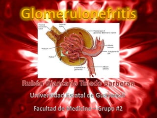 Glomerulonefritis
 