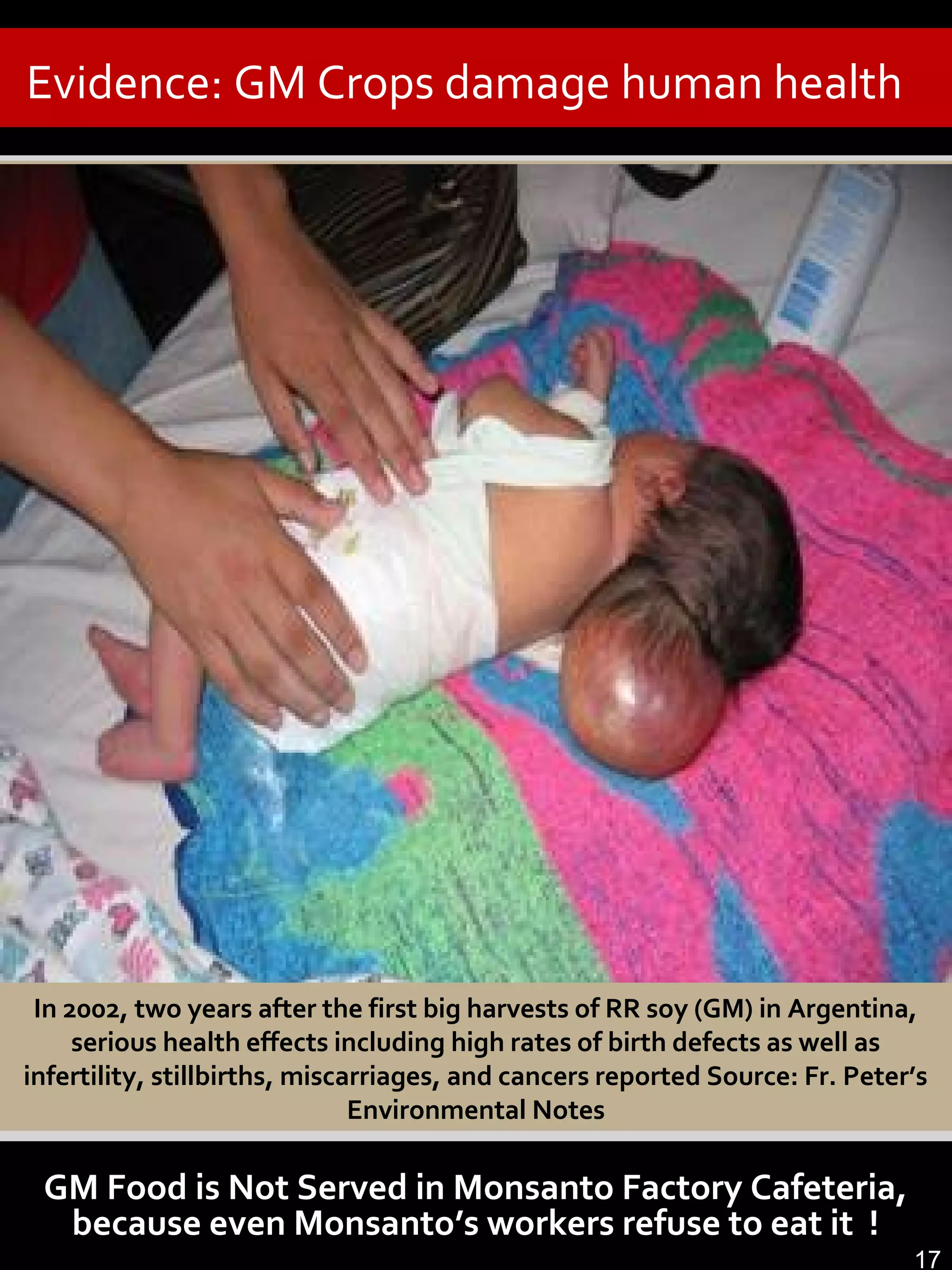Evidence: GM Crops damage human health
10
In 2002, two years after the first big harvests of RR soy (GM) in Argentina,
serious health effects including high rates of birth defects as well as
infertility, stillbirths, miscarriages, and cancers reported Source: Fr. Peter’s
Environmental Notes
GM Food is Not Served in Monsanto Factory Cafeteria,
because even Monsanto’s workers refuse to eat it !
17
 