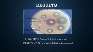 RESULTS
SENSITIVE: Zone of inhibition is observed
RESISTANT: No zone of inhibition is observed
 