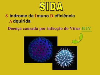 SIDA S índrome da  I muno  D eficiência  A dquirida Doença causada por infecção do Vírus  HIV 