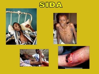 SIDA 
