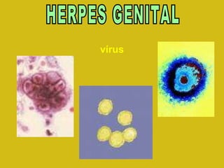 HERPES GENITAL vírus 