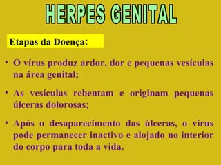 HERPES GENITAL O vírus produz ardor, dor e pequenas vesículas na área genital; As vesículas rebentam e originam pequenas úlceras dolorosas; Após o desaparecimento das úlceras, o vírus pode permanecer inactivo e alojado no interior do corpo para toda a vida. Etapas da Doença: 