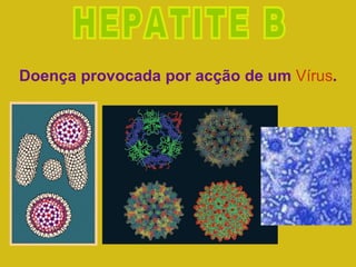 HEPATITE B Doença provocada por acção de um  Vírus . 