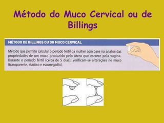 Método do Muco Cervical ou de Billings 