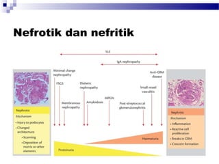 Nefrotik dan nefritik
 