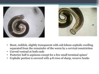 • Stout, reddish, slightly transparent with sub lobose cephalic swelling
separated from the remainder of the worm by a cervical constriction
• Curved ventrad at both ends
• Posterior half is aspinous except for a few small terminal spines’
• Cephalic portion is covered with 4-8 rows of sharp, recurve hooks
 