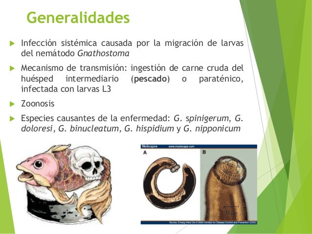Gnatostomiasis
