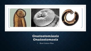 Gnatostomiasis
Gnatostomosis
• René Juárez Díaz
 