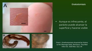 Gnatostomiasis PPT
