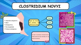 CLOSTRIDIUM NOVYI
Según las toxinas
que produce, se
clasifica en 3 tipos:
El tipo A produce mionecrosis e
infecciones de las heridas en los
seres humanos.
Tipo A
Tipo B
Tipo C
Anaerobio obligatorio
Móvil
Grampositivo
No encapsulado
Produce endosporas.
 