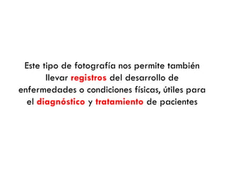 Este tipo de fotografía nos permite también
llevar registros del desarrollo de
enfermedades o condiciones físicas, útiles para
el diagnóstico y tratamiento de pacientes
 