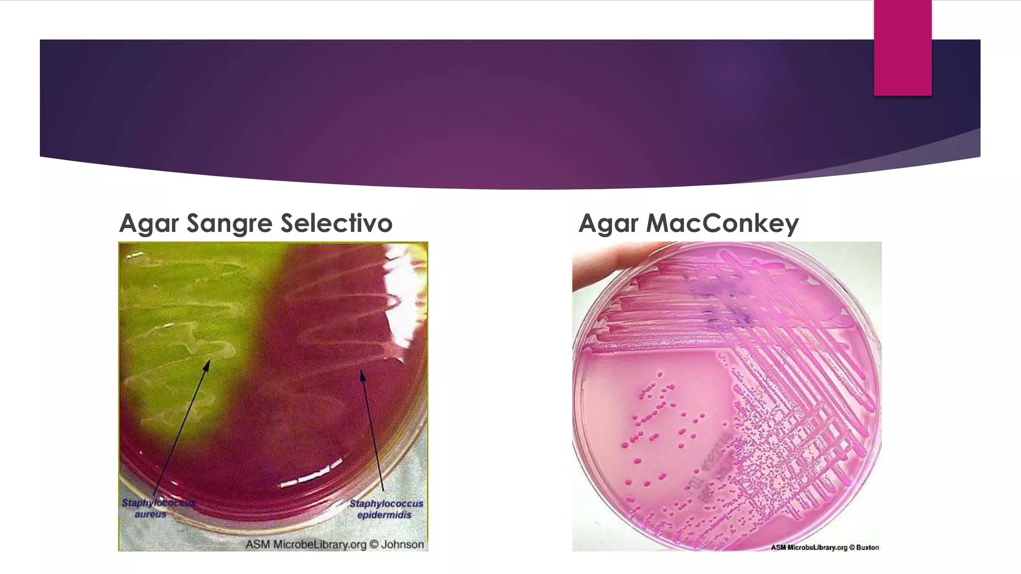 Agar Sangre Selectivo Agar MacConkey
 