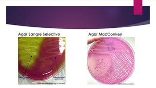 Agar Sangre Selectivo Agar MacConkey
 