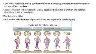 • Dystonic: repetitive muscle contractions result in twisting and repetitive movements or
abnormal fixed postures.
• Ataxic : lesion in the cerebellum. Mainly associated with inco-orination and balance
disturbance. Wide based gait
Mixed cerebral palsy
• Include both the features of pyramidal and extrapyramidal cerebral palsy
 
