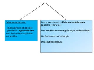 Faible grossissement:
- lésions diffuses et globales
- glomérules hypercellulaires
avec des lumières capillaires
peu visibles.
Fort grossissement: 4 lésions caractéristiques
(globales et diffuses) :
Une prolifération mésangiale (et/ou endocapillaire)
Un épaississement mésangial
Des doubles contours
 