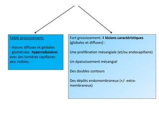 Faible grossissement:
- lésions diffuses et globales
- glomérules hypercellulaires
avec des lumières capillaires
peu visibles.
Fort grossissement: 4 lésions caractéristiques
(globales et diffuses) :
Une prolifération mésangiale (et/ou endocapillaire)
Un épaississement mésangial
Des doubles contours
Des dépôts endomembraneux (+/- extra-
membraneux)
 