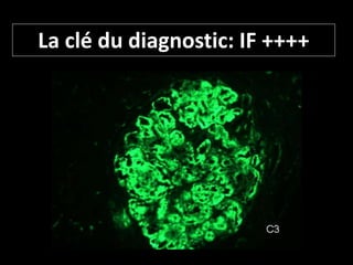 La clé du diagnostic: IF ++++
 