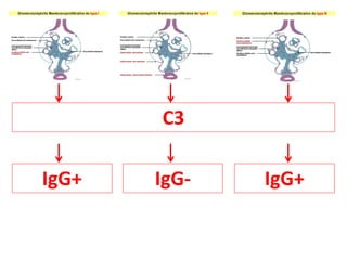 C3
IgG+
IgG+ IgG-
 