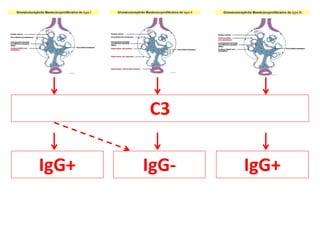 C3
IgG+
IgG+ IgG-
 