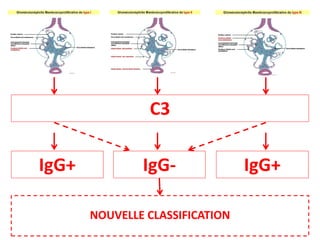 C3
IgG+
IgG+ IgG-
NOUVELLE CLASSIFICATION
 