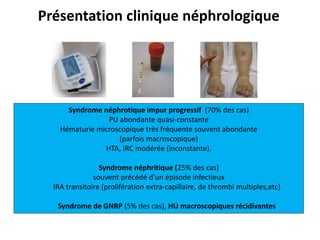 Syndrome néphrotique impur progressif (70% des cas)
PU abondante quasi-constante
Hématurie microscopique très fréquente souvent abondante
(parfois macroscopique)
HTA, IRC modérée (inconstante).
Syndrome néphritique (25% des cas)
souvent précédé d'un épisode infectieux
IRA transitoire (prolifération extra-capillaire, de thrombi multiples,etc)
Syndrome de GNRP (5% des cas), HU macroscopiques récidivantes
Présentation clinique néphrologique
 