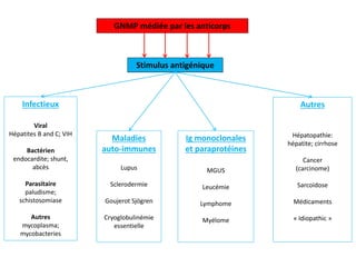 GNMP médiée par les anticorps
Stimulus antigénique
Infectieux
Maladies
auto-immunes
Ig monoclonales
et paraprotéines
Autres
Hépatopathie:
hépatite; cirrhose
Cancer
(carcinome)
Sarcoidose
Médicaments
« Idiopathic »
Viral
Hépatites B and C; VIH
Bactérien
endocardite; shunt,
abcès
Parasitaire
paludisme;
schistosomiase
Autres
mycoplasma;
mycobacteries
Lupus
Sclerodermie
Goujerot Sjögren
Cryoglobulinémie
essentielle
MGUS
Leucémie
Lymphome
Myélome
 