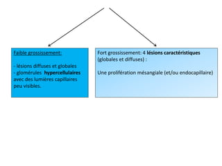 Faible grossissement:
- lésions diffuses et globales
- glomérules hypercellulaires
avec des lumières capillaires
peu visibles.
Fort grossissement: 4 lésions caractéristiques
(globales et diffuses) :
Une prolifération mésangiale (et/ou endocapillaire)
 