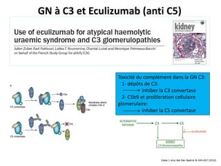 GN à C3 et Eculizumab (anti C5)
Toxicité du complément dans la GN C3:
1- dépôts de C3:
inhiber la C3 convertase
2- C5b9 et proliferation cellulaire
glomerulaire:
inhiber la C5 convertase
 