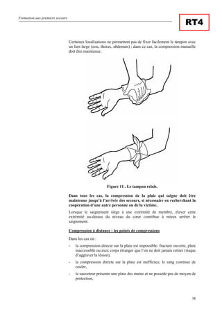 Formation aux premiers secours
38
RT4
Certaines localisations ne permettent pas de fixer facilement le tampon avec
un lien large (cou, thorax, abdomen) ; dans ce cas, la compression manuelle
doit être maintenue.
Figure 11 . Le tampon relais.
Dans tous les cas, la compression de la plaie qui saigne doit être
maintenue jusqu’à l’arrivée des secours, si nécessaire en recherchant la
coopération d’une autre personne ou de la victime.
Lorsque le saignement siège à une extrémité de membre, élever cette
extrémité au-dessus du niveau du cœur contribue à mieux arrêter le
saignement.
Compression à distance : les points de compressions
Dans les cas où :
- la compression directe sur la plaie est impossible: fracture ouverte, plaie
inaccessible ou avec corps étranger que l’on ne doit jamais retirer (risque
d’aggraver la lésion),
- la compression directe sur la plaie est inefficace, le sang continue de
couler,
- le sauveteur présente une plaie des mains et ne possède pas de moyen de
protection,
 