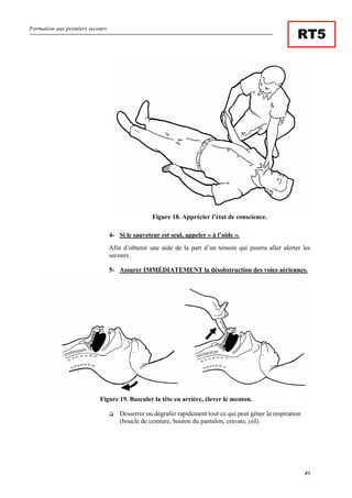 Formation aux premiers secours
49
RT5
Figure 18. Apprécier l’état de conscience.
4- Si le sauveteur est seul, appeler « à l’aide ».
Afin d’obtenir une aide de la part d’un témoin qui pourra aller alerter les
secours.
5- Assurer IMMÉDIATEMENT la désobstruction des voies aériennes.
Figure 19. Basculer la tête en arrière, élever le menton.
Desserrer ou dégrafer rapidement tout ce qui peut gêner la respiration
(boucle de ceinture, bouton du pantalon, cravate, col).
 