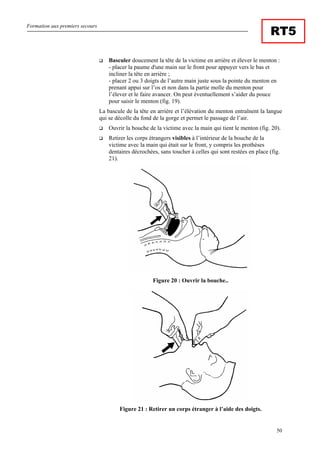 Formation aux premiers secours
50
RT5
Basculer doucement la tête de la victime en arrière et élever le menton :
- placer la paume d'une main sur le front pour appuyer vers le bas et
incliner la tête en arrière ;
- placer 2 ou 3 doigts de l’autre main juste sous la pointe du menton en
prenant appui sur l’os et non dans la partie molle du menton pour
l’élever et le faire avancer. On peut éventuellement s’aider du pouce
pour saisir le menton (fig. 19).
La bascule de la tête en arrière et l’élévation du menton entraînent la langue
qui se décolle du fond de la gorge et permet le passage de l’air.
Ouvrir la bouche de la victime avec la main qui tient le menton (fig. 20).
Retirer les corps étrangers visibles à l’intérieur de la bouche de la
victime avec la main qui était sur le front, y compris les prothèses
dentaires décrochées, sans toucher à celles qui sont restées en place (fig.
21).
Figure 20 : Ouvrir la bouche..
Figure 21 : Retirer un corps étranger à l’aide des doigts.
 
