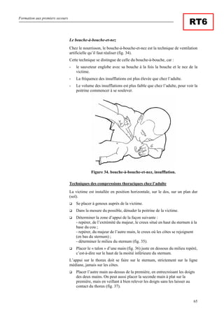 Formation aux premiers secours
65
RT6
Le bouche-à-bouche-et-nez
Chez le nourrisson, le bouche-à-bouche-et-nez est la technique de ventilation
artificielle qu’il faut réaliser (fig. 34).
Cette technique se distingue de celle du bouche-à-bouche, car :
- le sauveteur englobe avec sa bouche à la fois la bouche et le nez de la
victime.
- La fréquence des insufflations est plus élevée que chez l’adulte.
- Le volume des insufflations est plus faible que chez l’adulte, pour voir la
poitrine commencer à se soulever.
Figure 34. bouche-à-bouche-et-nez, insufflation.
Techniques des compressions thoraciques chez l’adulte
La victime est installée en position horizontale, sur le dos, sur un plan dur
(sol).
Se placer à genoux auprès de la victime.
Dans la mesure du possible, dénuder la poitrine de la victime.
Déterminer la zone d’appui de la façon suivante :
- repérer, de l’extrémité du majeur, le creux situé en haut du sternum à la
base du cou ;
- repérer, du majeur de l’autre main, le creux où les côtes se rejoignent
(en bas du sternum) ;
- déterminer le milieu du sternum (fig. 35).
Placer le « talon » d’une main (fig. 36) juste en dessous du milieu repéré,
c’est-à-dire sur le haut de la moitié inférieure du sternum.
L’appui sur le thorax doit se faire sur le sternum, strictement sur la ligne
médiane, jamais sur les côtes.
Placer l’autre main au-dessus de la première, en entrecroisant les doigts
des deux mains. On peut aussi placer la seconde main à plat sur la
première, mais en veillant à bien relever les doigts sans les laisser au
contact du thorax (fig. 37).
 