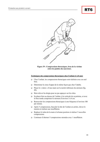 Formation aux premiers secours
68
RT6
Figure 39 : Compressions thoraciques, bras de la victime
entre les jambes du sauveteur.
Techniques des compressions thoraciques chez l’enfant (1 à 8 ans)
Chez l’enfant, les compressions thoraciques sont réalisées avec un seul
bras.
Déterminer la zone d’appui de la même façon que chez l’adulte.
Placer le « talon » d’une main sur la moitié inférieure du sternum (fig.
40).
Bien relever les doigts pour ne pas appuyer sur les côtes.
Se placer bien au dessus de l’enfant, à la verticale de sa poitrine, et avec
le bras tendu comprimer le sternum d’environ 3 à 4 cm.
Renouveler les compressions thoraciques à une fréquence d’environ 100
par minute.
Après 5 compressions, basculer la tête de l’enfant en arrière, élever le
menton et réaliser une insufflation.
Replacer le talon de la main à la bonne position et réaliser 5 nouvelles
compressions.
Continuer d’alterner 5 compressions sternales avec 1 insufflation.
 