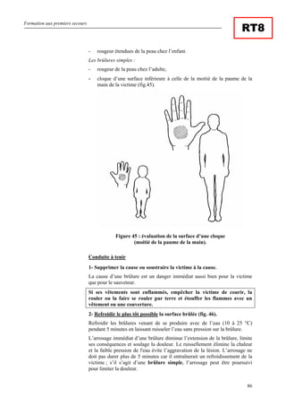 Formation aux premiers secours
86
RT8
- rougeur étendues de la peau chez l’enfant.
Les brûlures simples :
- rougeur de la peau chez l’adulte,
- cloque d’une surface inférieure à celle de la moitié de la paume de la
main de la victime (fig.45).
Figure 45 : évaluation de la surface d’une cloque
(moitié de la paume de la main).
Conduite à tenir
1- Supprimer la cause ou soustraire la victime à la cause.
La cause d’une brûlure est un danger immédiat aussi bien pour la victime
que pour le sauveteur.
Si ses vêtements sont enflammés, empêcher la victime de courir, la
rouler ou la faire se rouler par terre et étouffer les flammes avec un
vêtement ou une couverture.
2- Refroidir le plus tôt possible la surface brûlée (fig. 46).
Refroidir les brûlures venant de se produire avec de l’eau (10 à 25 °C)
pendant 5 minutes en laissant ruisseler l’eau sans pression sur la brûlure.
L’arrosage immédiat d’une brûlure diminue l’extension de la brûlure, limite
ses conséquences et soulage la douleur. Le ruissellement élimine la chaleur
et la faible pression de l'eau évite l’aggravation de la lésion. L’arrosage ne
doit pas durer plus de 5 minutes car il entraînerait un refroidissement de la
victime ; s’il s’agit d’une brûlure simple, l’arrosage peut être poursuivi
pour limiter la douleur.
 
