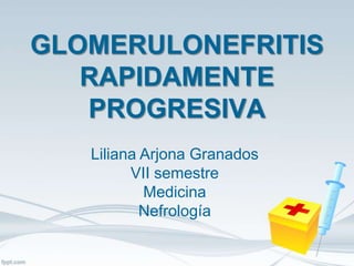 GLOMERULONEFRITIS
   RAPIDAMENTE
   PROGRESIVA
   Liliana Arjona Granados
         VII semestre
           Medicina
           Nefrología
 