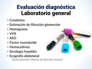Evaluación diagnóstica
Laboratorio general
• Creatinina
• Estimación de filtración glomerular
• Hemograma
• VHS
• ASO
• Factor reumatoide
• Hemocultivos
• Serología hepatitis
• Ecografía abdominal
Generalmente riñones de tamaño normal
 