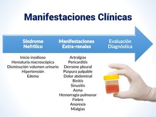 Manifestaciones Clínicas
Evaluación
Diagnóstica
Manifestaciones
Extra-renales
Síndrome
Nefrítico
Artralgias
Pericarditis
Derrame pleural
Púrpura palpable
Dolor abdominal
Rinitis
Sinusitis
Asma
Hemorragia pulmonar
Fiebre
Anorexia
Mialgias
Inicio insidioso
Hematuria macroscópica
Disminución volumen urinario
Hipertensión
Edema
 