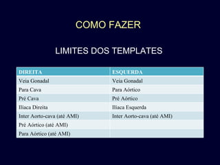 COMO FAZER LIMITES DOS TEMPLATES DIREITA ESQUERDA Veia Gonadal Veia Gonadal Para Cava Para Aórtico Pré Cava Pré Aórtico Ilíaca Direita Ilíaca Esquerda Inter Aorto-cava (até AMI) Inter Aorto-cava (até AMI) Pré Aórtico (até AMI) Para Aórtico (até AMI) 