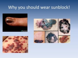 FoodLack of food sourcesMost important in poor, developing countries