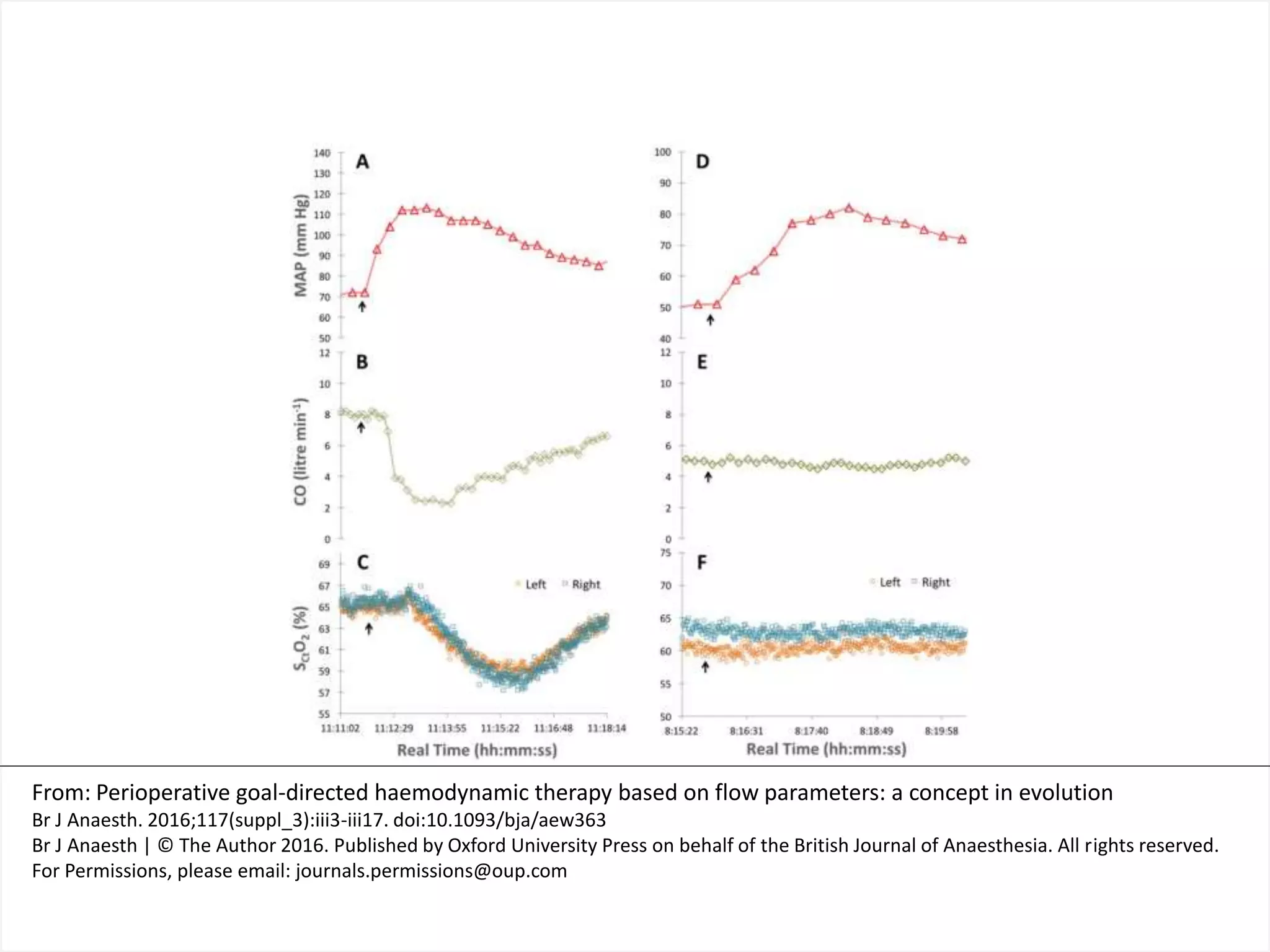Goal directed fluid therapy | PPTX