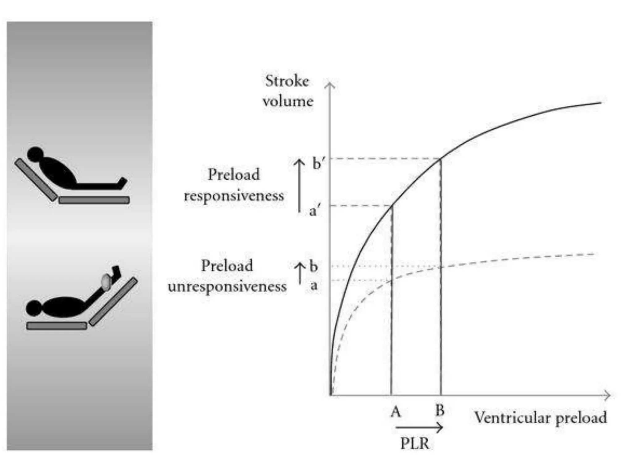 Goal directed fluid therapy | PPTX