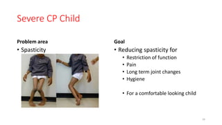 Spacicity Problem Goals in rehabilitaion of cerebral palsy child | PPTX
