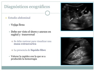 Diagnósticos ecográficos

   Estudio abdominal

       Vejiga llena

       Debe ser visto el útero y anexos en
        sagital y transversal

           Se debe rastrear para visualizar una
            masa extraovarica

           La presencia de líquido libre

       Valorar la rapidez con la que se a
        producido la hemorragia
 