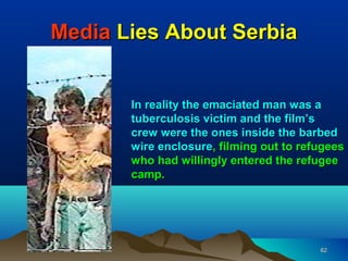 Media Lies About Serbia


       In reality the emaciated man was a
       tuberculosis victim and the film’s
       crew were the ones inside the barbed
       wire enclosure, filming out to refugees
       who had willingly entered the refugee
       camp.




                                         62
 