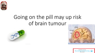 Going on the pill may up risk
of brain tumour
 